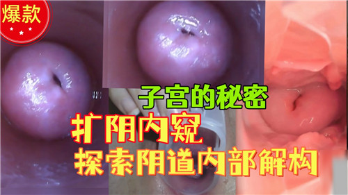 JUL-233 极品人妻医疗调教 扩阴器深挖骚穴内窥全记录